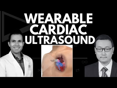 HealthTech Breakthrough: WEARABLE CARDIAC ULTRASOUND #DeltaHealthTechInnovators #startup #HealthTech